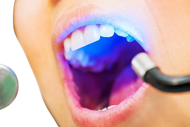 Invisalign and Orthodontic Care