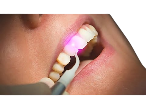 Invisalign and Orthodontic Care