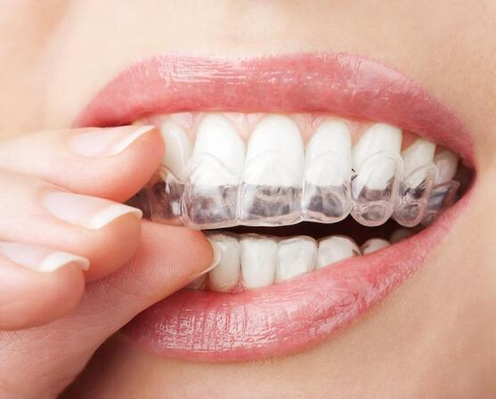 Invisalign and Orthodontic Care
